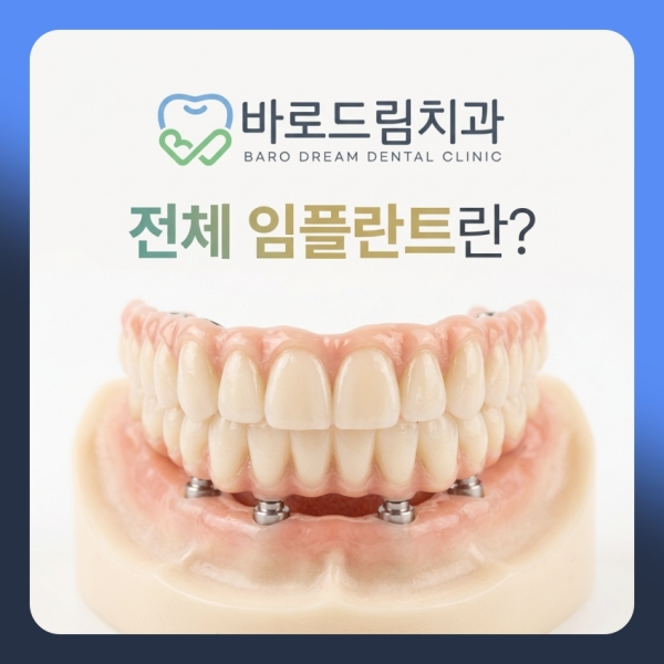 전체 임플란트가 궁금하다면, 바로드림치과에서 나에게 맞는 치료 방향을 상담해 보세요.